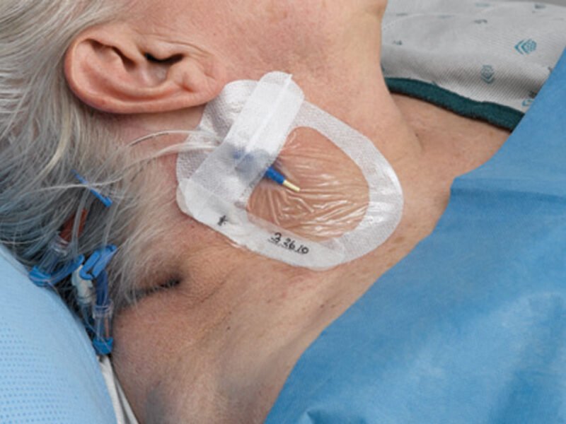 Tegaderm Advanced keskuslaskimokatetrin suojasidos - Image 2