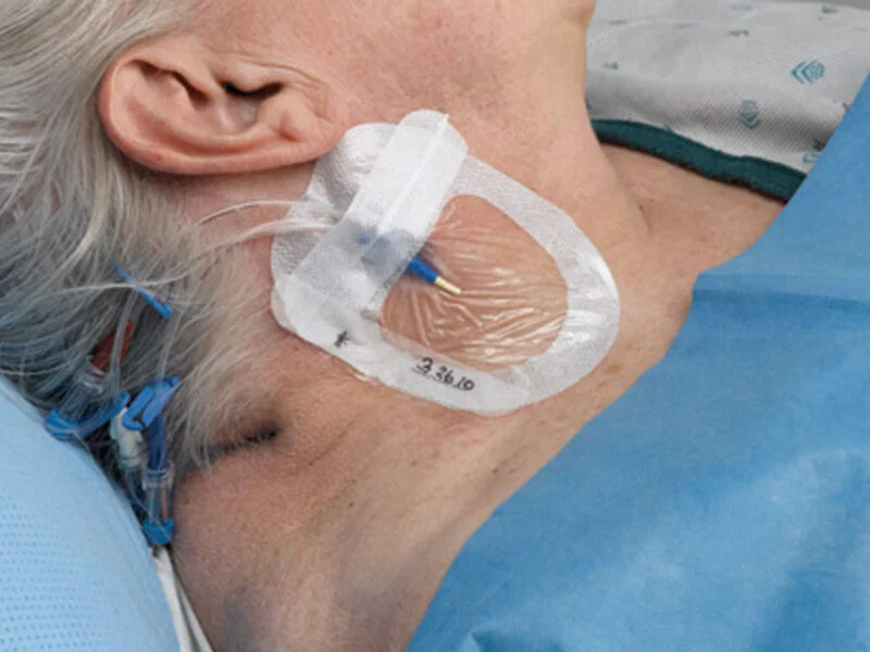 Tegaderm Advanced keskuslaskimokatetrin suojasidos - Image 2