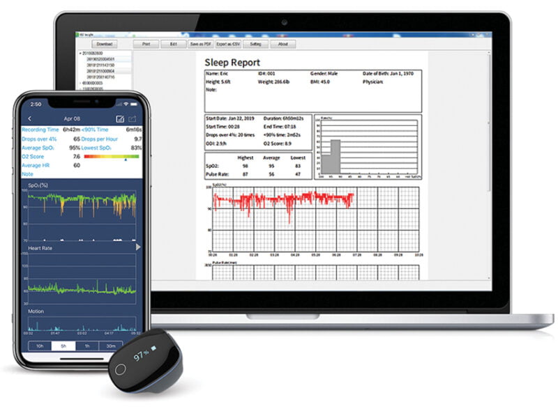 O2ring™ Saturaatiosormus jatkuvaan mittaukseen lapsille - Image 3